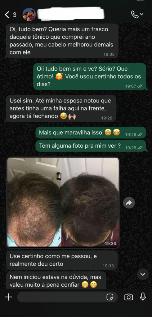 provas sociais minoxidil