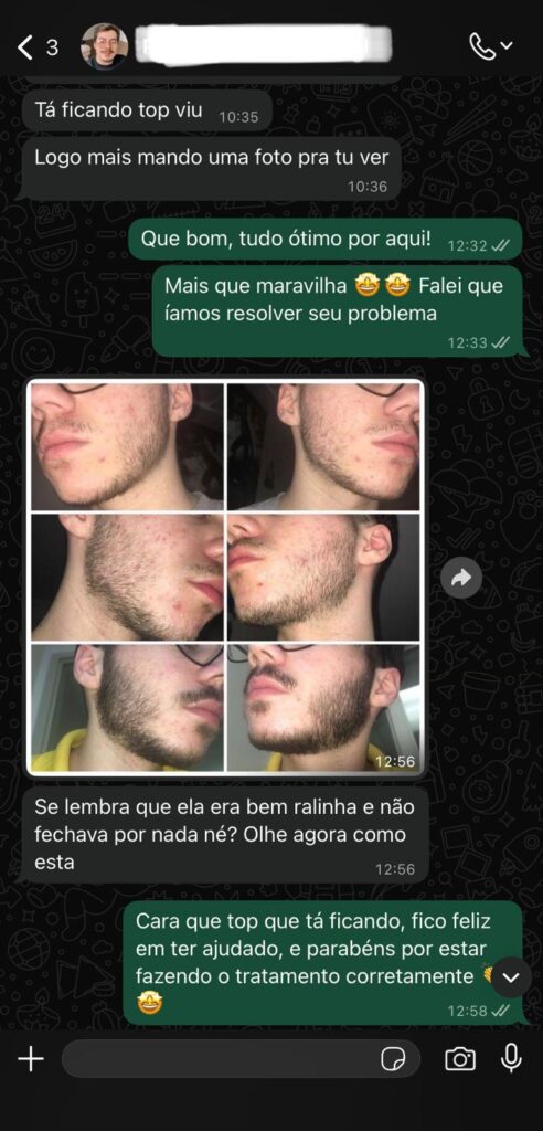 provas sociais minoxidil
