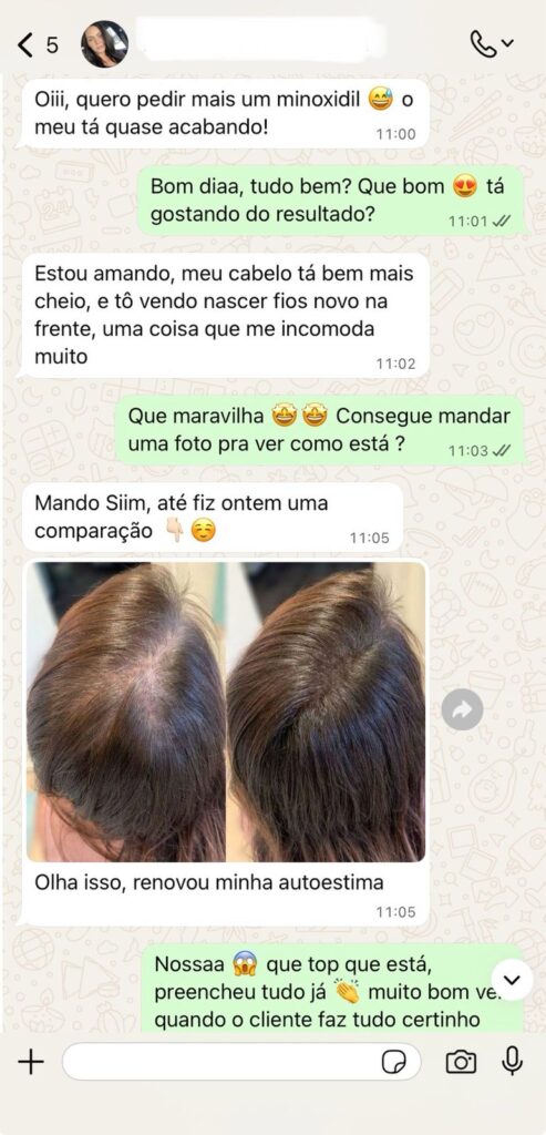 provas sociais minoxidil