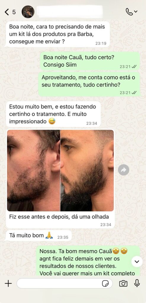 provas sociais minoxidil
